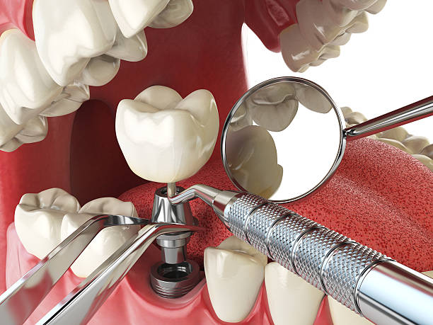 Best Emergency Broken Tooth Repair in Harveys Lake, PA